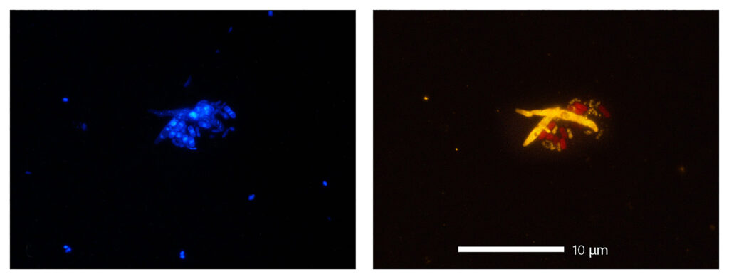 Imagens microscópicas de sinais fluorescentes após a coloração do DNA.